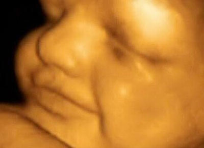 胎儿发育过程图片 胎儿发育全过程高清图文详解(3)