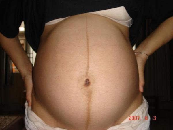 怀孕了，怎样科学判断孩子是男是女?(2)
