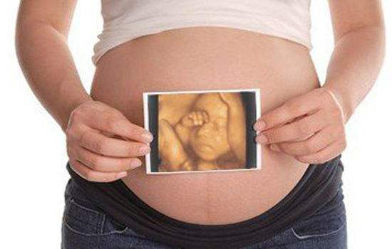 孕妇做四维彩超需要空腹吗 四维彩超都检查些什(2)